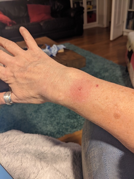 Do I need antibiotics? (bastard cat)