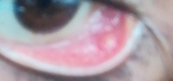 What the hell is this in my eye?
