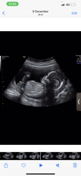 Boy or girl?