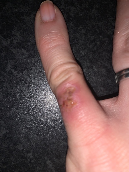 Is this infected?