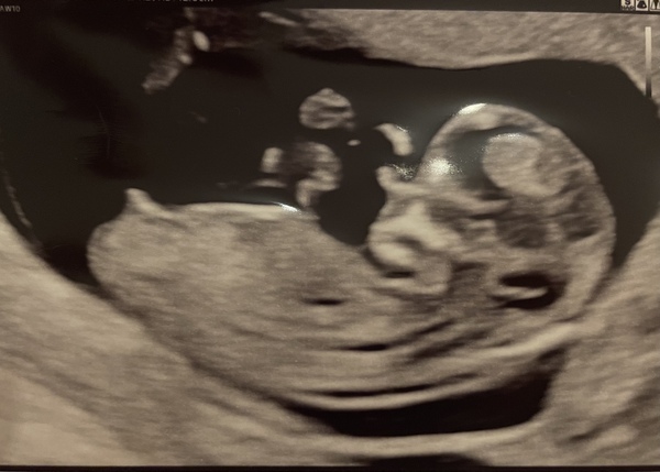 Due July 2022 (thread 2)