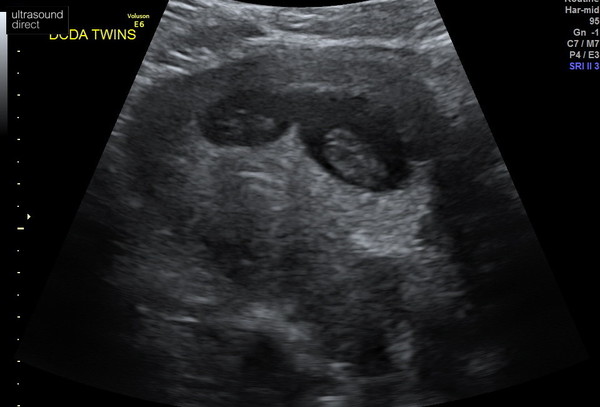 Due July 2022 (thread 2)