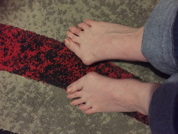 To fucking HATE bunions