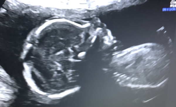 Due May 2022 (thread 3)