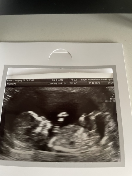 Nub theory boy or girl?! 💗