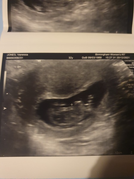 Due July 2022 (thread 2)