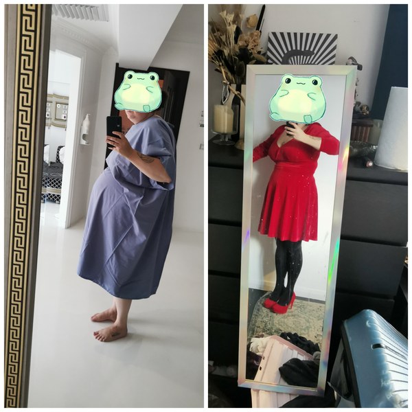 Bariatric surgery thread 3