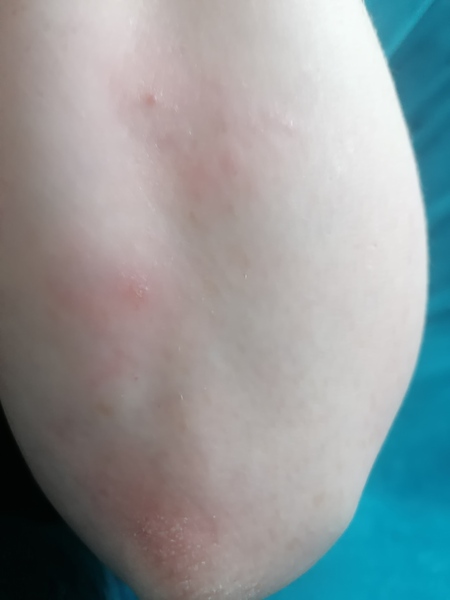 Weird v sore spot things