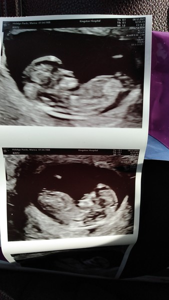 Due June 2022 (thread five)