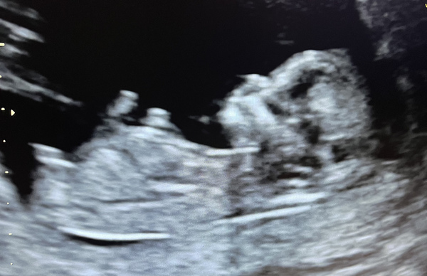 Boy or girl?