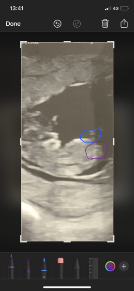 Can anyone predict gender