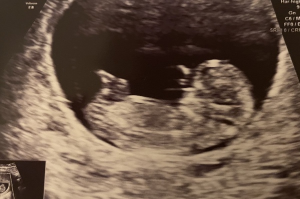 Due July 2022 (thread 2)