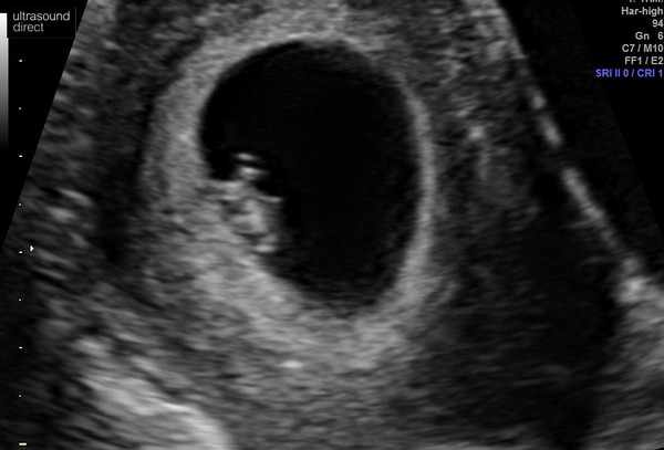 Due July/August 2022