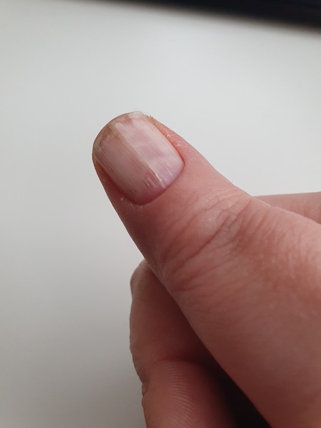 What's going on with my nails?
