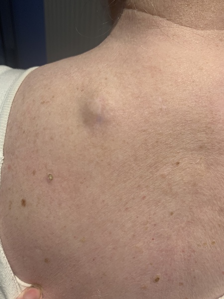 Sporner help!