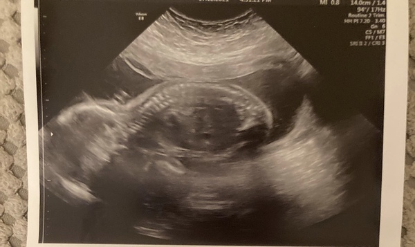 Due May 2022 (thread 3)