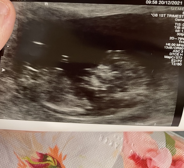 Gender guess please