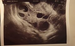 Fertility Appointments and Beyond.... the journey continues