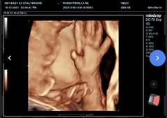 11 days late -BFN! Please someone give me a success story.