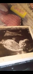 Guesses boy or girl 😍