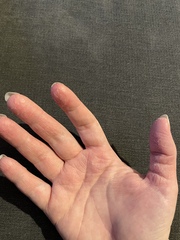Any dermatologists? I’m at my wits end!