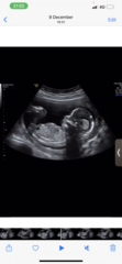 Boy or girl?
