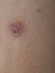 Since i cant be seen til Jan what do you think this is?