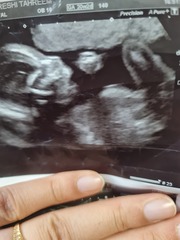 Scan pic - anyone guess gender?