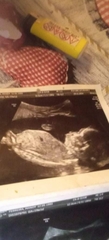 Guesses boy or girl 😍