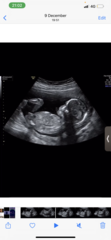 Boy or girl?