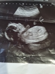 Scan pic - anyone guess gender?