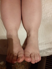 Help! Do I need an X-ray?