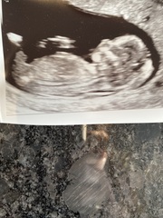 Any guesses? Boy or girl?