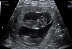Due July 2022 (thread 2)