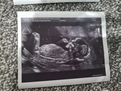 Due June 2022 (thread five)