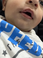 Baby cut his lip need advice PANICKING!