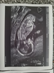 Due June 2022 (thread five)