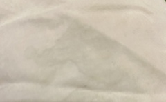 Is this amniotic fluid, discharge or urine - warning pictures attached