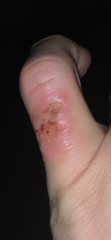 Is this infected?