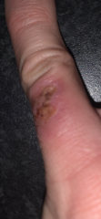 Is this infected?