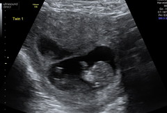 Due July 2022 (thread 2)
