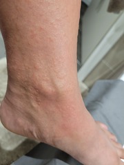 37 Weeks Rash help