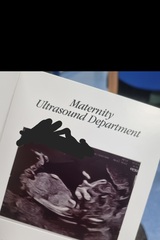 Boy or girl ? 13 week scan