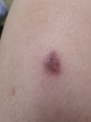 Since i cant be seen til Jan what do you think this is?