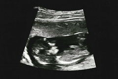 Nub theory - boy or girl?