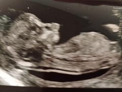 Boy or girl?