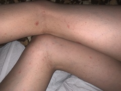 What is this rash in my son? (pics incl)