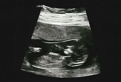 Nub theory - boy or girl?