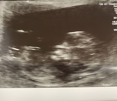 Gender guess please