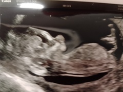 Boy or girl?